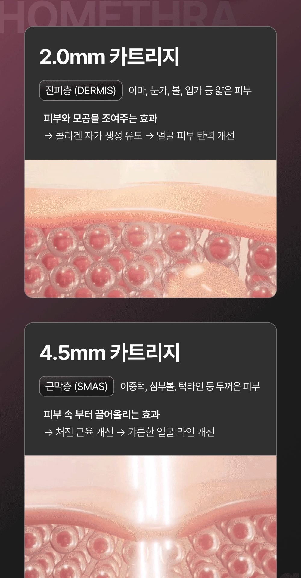 홈쎄라 야노시호 뷰티디바이스 10만샷 HIFU 하이푸 집중초음파 리프팅 디바이스 상세
