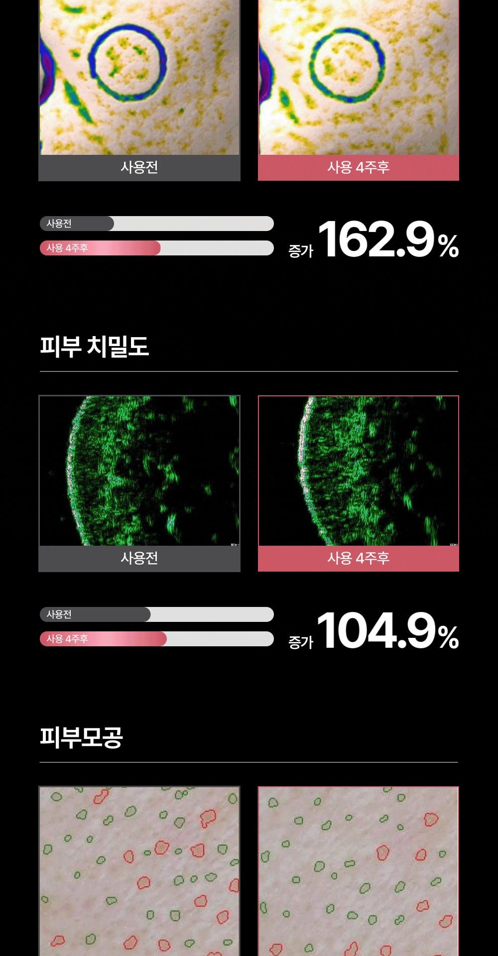 홈쎄라 야노시호 뷰티디바이스 10만샷 HIFU 하이푸 집중초음파 리프팅 디바이스 상세